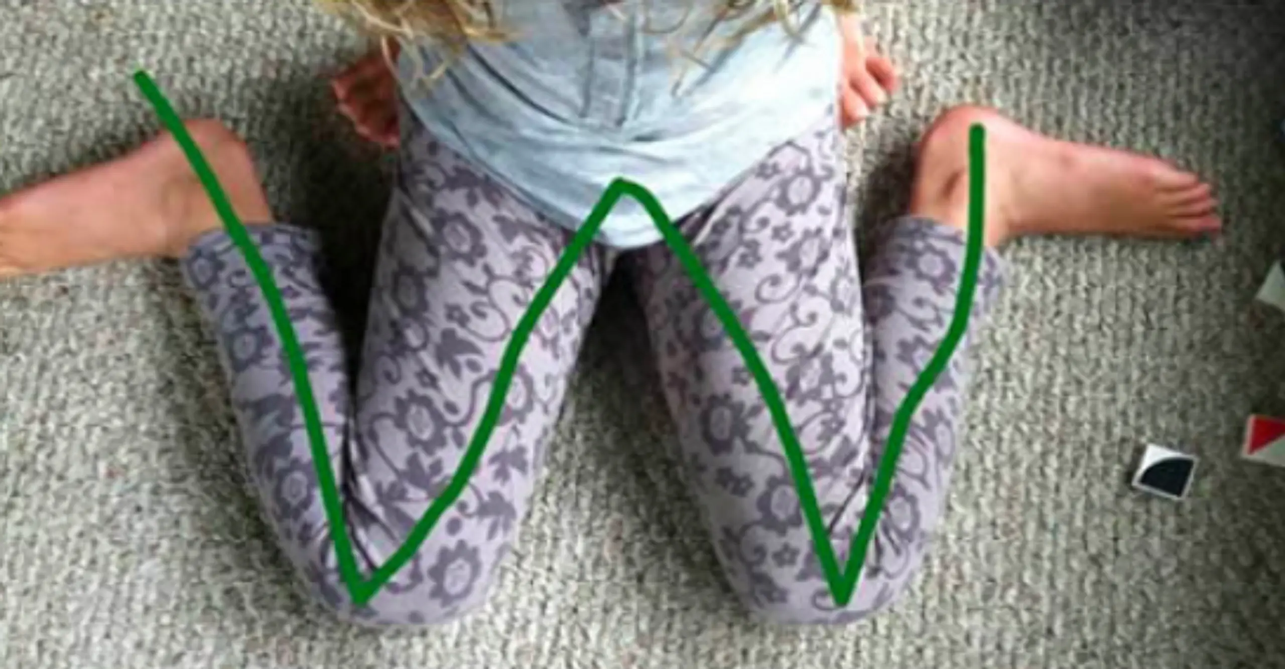 If You Ever See Your Child Sitting Like This, Stop Them Immediately