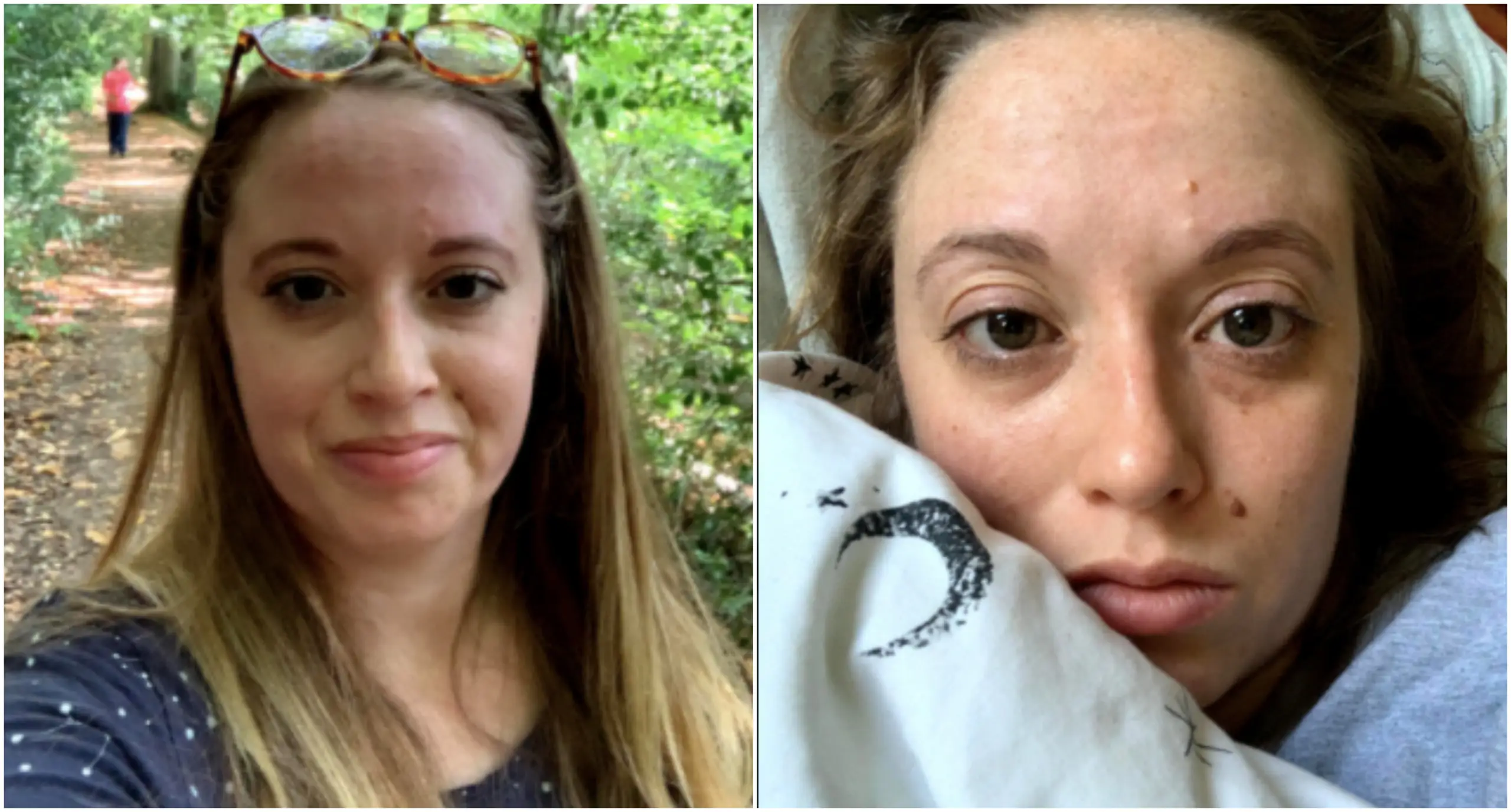 Long Covid leaves editor unable to read or spell: 'I'm questioning how permanent it all is'