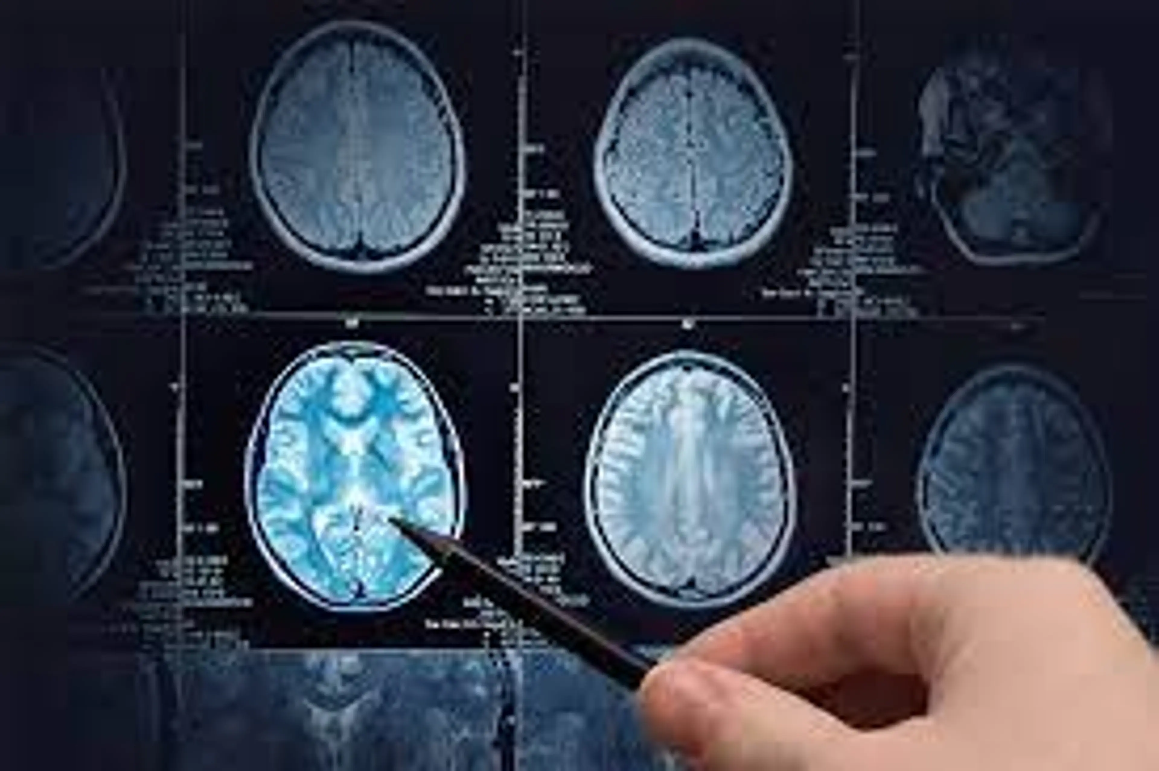 Bespoke Software in Healthcare: An Overview image